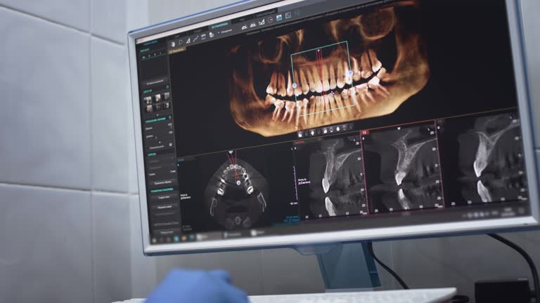 Full Mouth Reconstruction in St Peter, MN